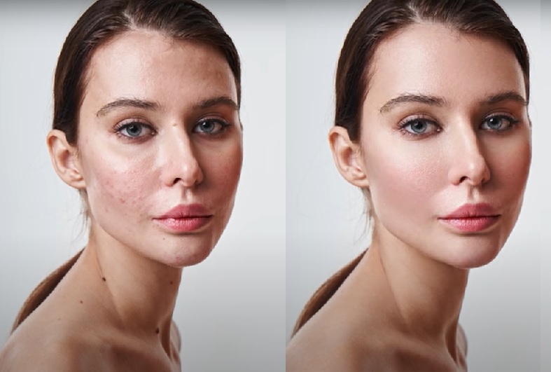 Exploring the Pros and Cons: AI-Based Photo Retouching vs. Human Touch
